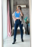 ZEBRA DESENLİ TUNİK CEKET